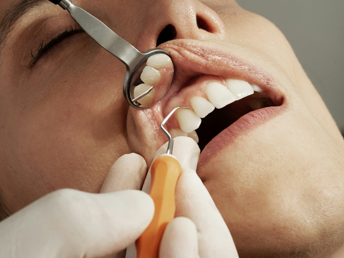 Exame odontológico com espelho clínico — imagem ilustrativa